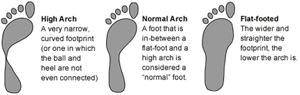 High arch, normal arch and flat arch.jpg